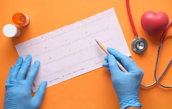 Tracciato di un elettrocardiogramma, simbolo della diagnosi assistita dall intelligenza artificiale