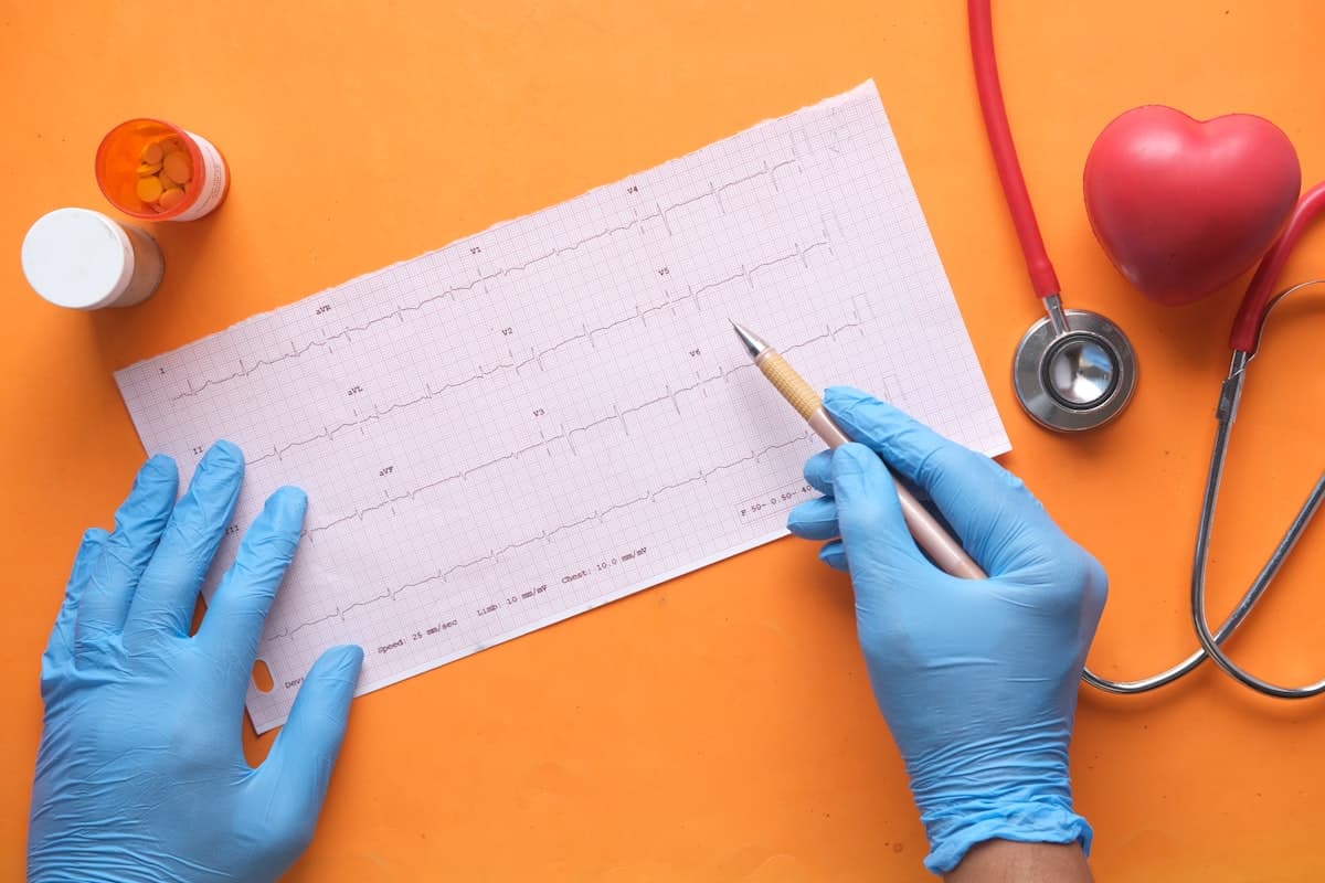 Tracciato di un elettrocardiogramma, simbolo della diagnosi assistita dall intelligenza artificiale