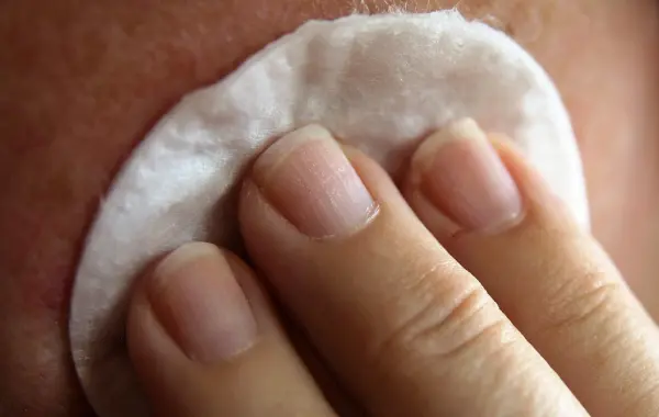 Cura della pelle del viso con crema, concetto di trattamento dermatologico